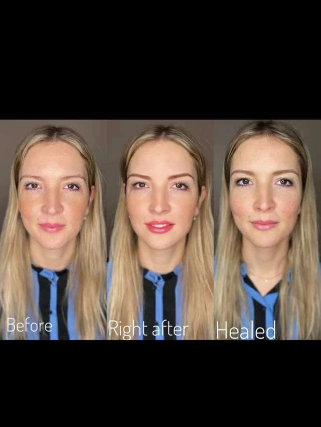 Permanent makeup af bryn – det handler ikke om mode, men om komfort og genskabelse

Permanent makeup (også kaldet bryntatovering) er ikke kun en skønhedstrend, men først og fremmest en praktisk løsning, der kan gøre hverdagen lettere og mere bekvem.
Det er særligt relevant, hvis:
	•	🔹 Du har mistet brynhår med alderen – pga. hormonelle ændringer, stress eller naturlig udtynding.
	•	🔹 Brynenes form er ændret eller blevet asymmetrisk.
	•	🔹 Du har følsom hud eller allergi overfor makeup.
	•	🔹 Dine bryn er meget lyse eller utydelige, og du ønsker mere definition.
	•	🔹 Du vil spare tid og ikke tegne bryn op hver morgen.

⸻

✔️ Det handler om frihed og selvtillid:

Med permanent makeup kan du:
	•	vågne op med naturligt definerede bryn hver dag,
	•	føle dig tryg uden makeup – i fitness, sauna eller ved stranden,
	•	slippe for at bekymre dig om sved, fugt eller udtværet kosmetik.